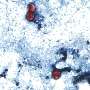 Outbreak of diarrhea-causing parasite grows to more than 1,000 cases