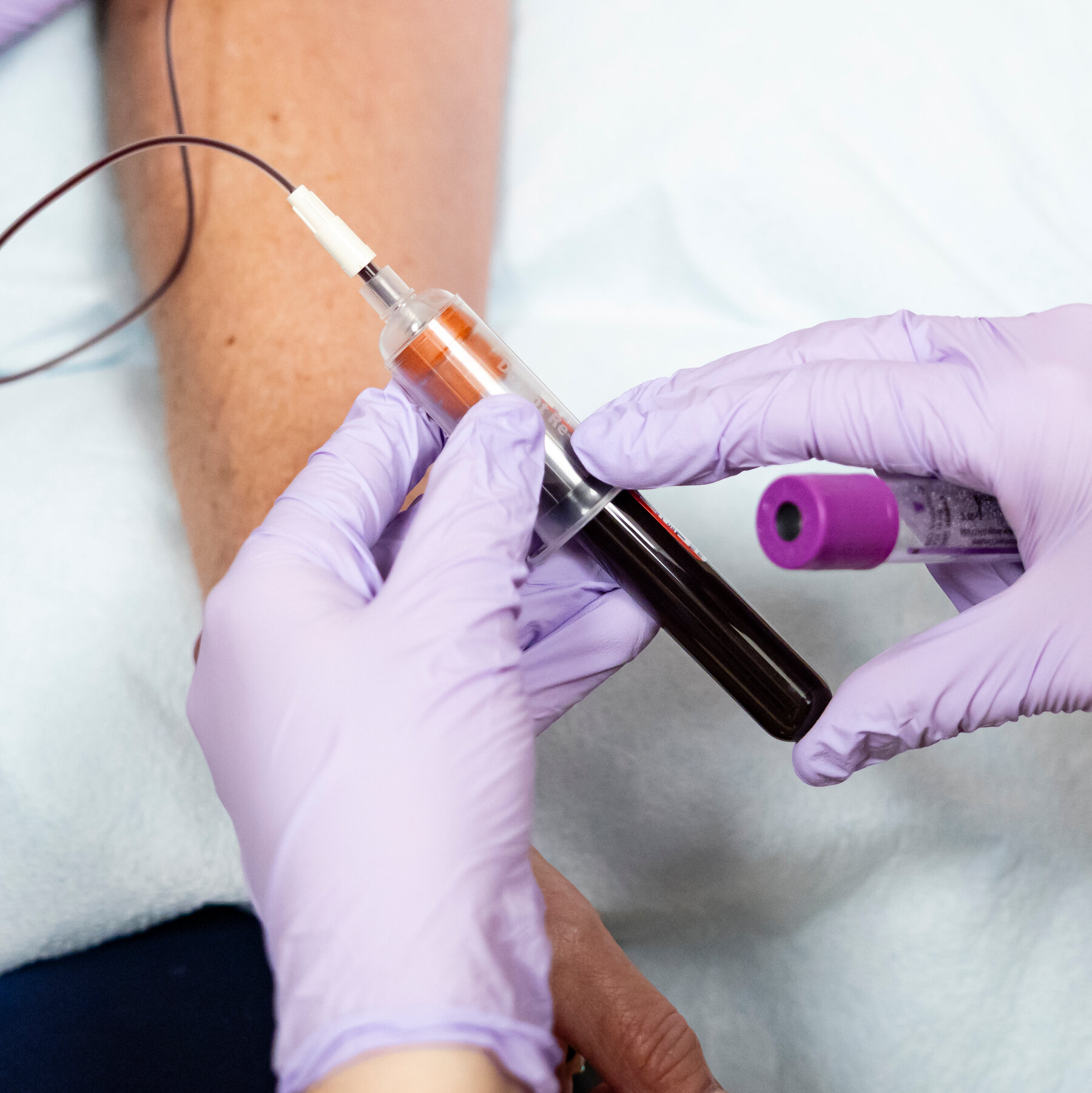 What to Know About the New Cholesterol Pill and How it Compares to Statins
