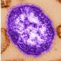 Coroner releases details of infants who died amid growing Pennsylvania measles outbreak