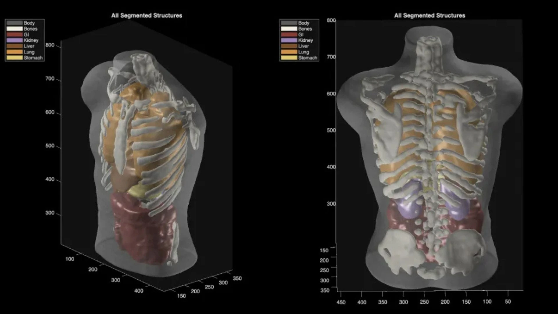 Midjourney Scanner: An AI that scans the body and replaces MRI