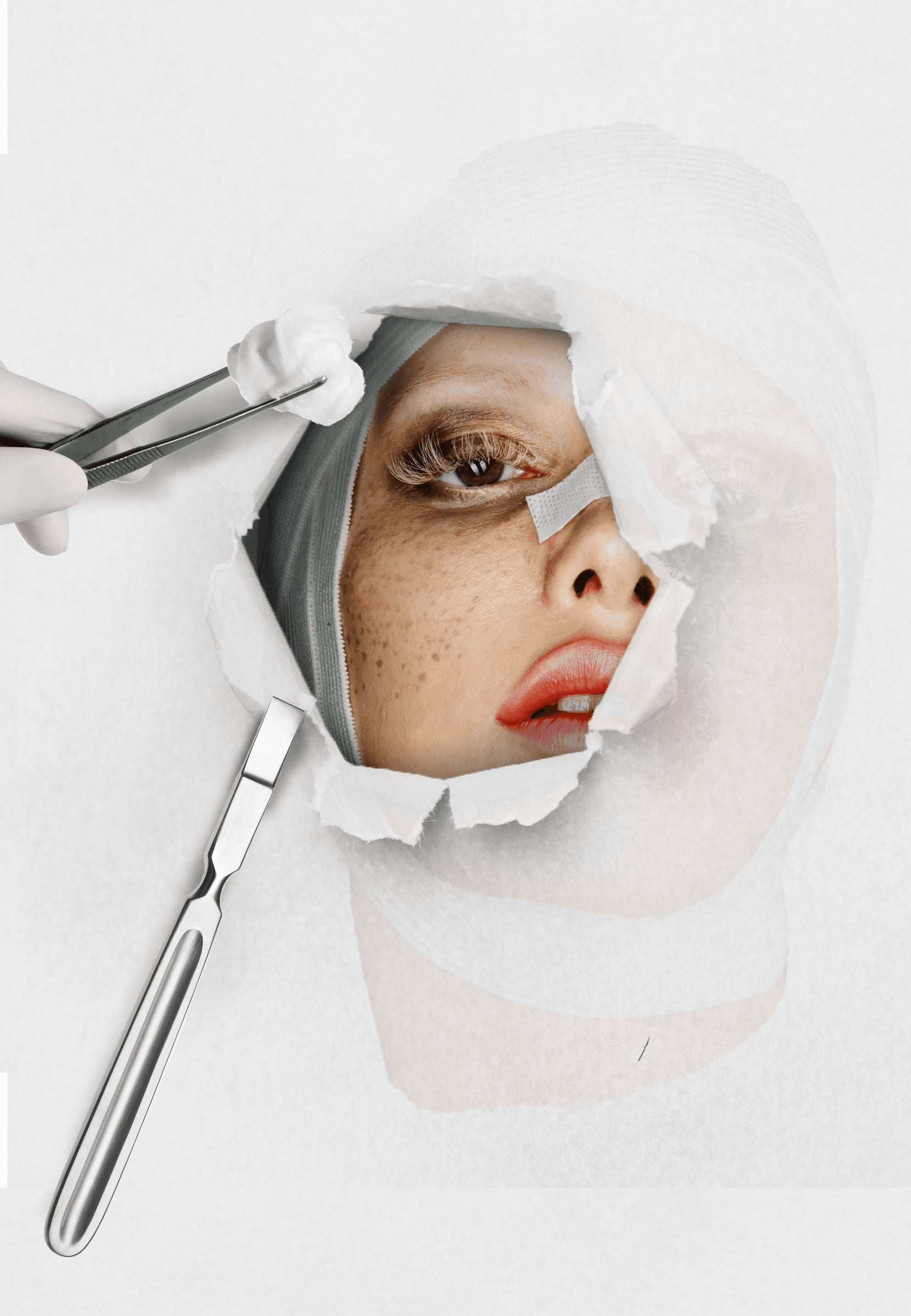 I Spent a Week as My Friend’s Facelift Nurse. Here’s What No One Tells You.