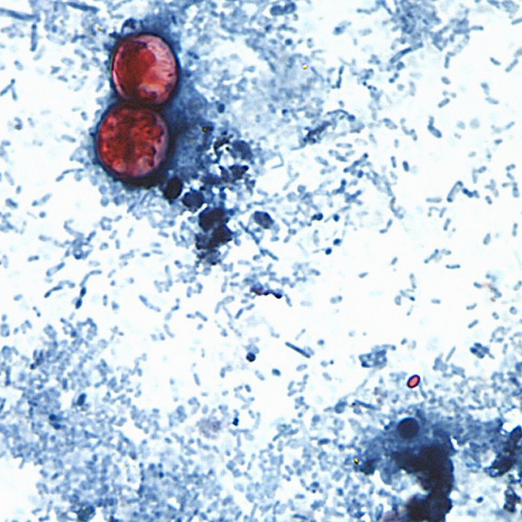 Cyclospora Spreads Through Human Feces. How Did It Get Into Our Food Supply?