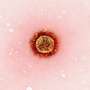 Contagious measles case reported at California theme park