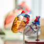 Eplontersen trial fails to meet primary endpoint in transthyretin-mediated amyloid cardiomyopathy