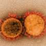 A lesser-known SARS-CoV-2 protein may offer clues to long COVID symptoms