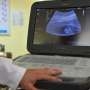 Simulated ultrasound images help develop better cardiovascular diagnostics