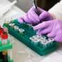 Blood-based test can predict risk of developing symptoms of Alzheimer's up to a decade early