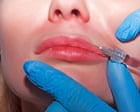 The pressure to change your face - podcast